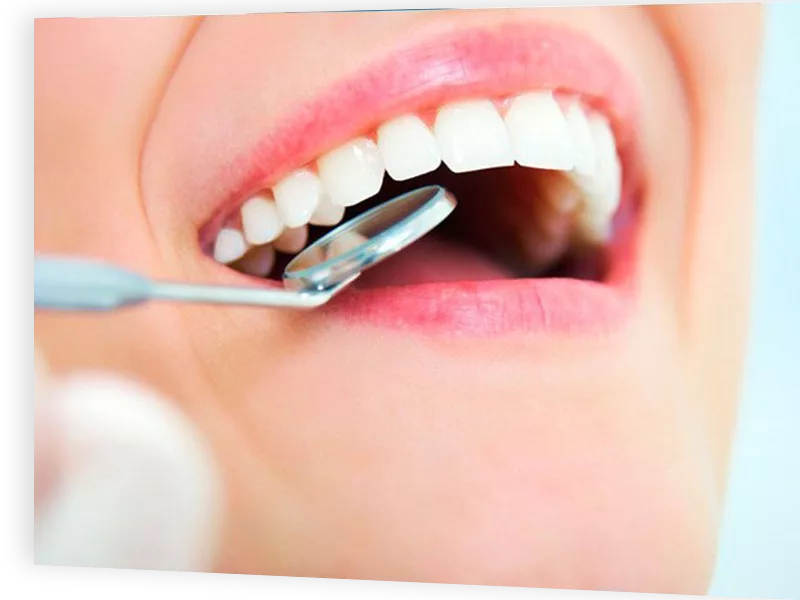 Endodoncia endodonciaENDODONCIA - Endodoncia